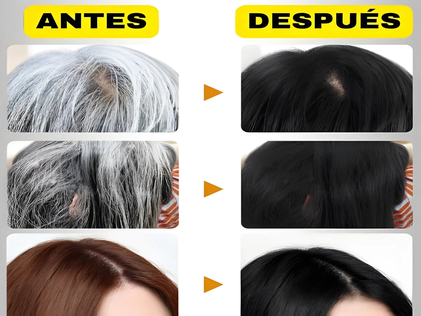 SHAMPOO ANTICANAS PARA MUJER