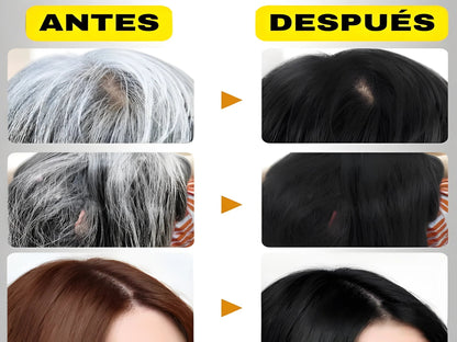 SHAMPOO ANTICANAS PARA MUJER